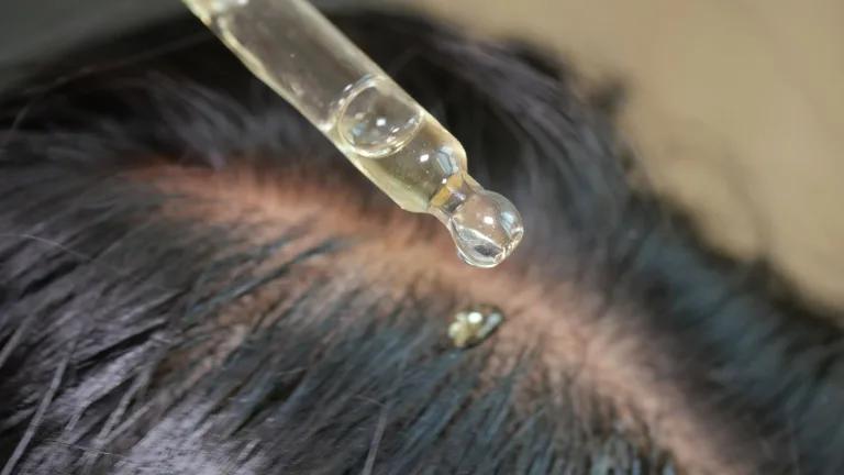 Loc-Safe Scalp Microbiome Serums for Healthy Scalps & Lightweight Loc Care