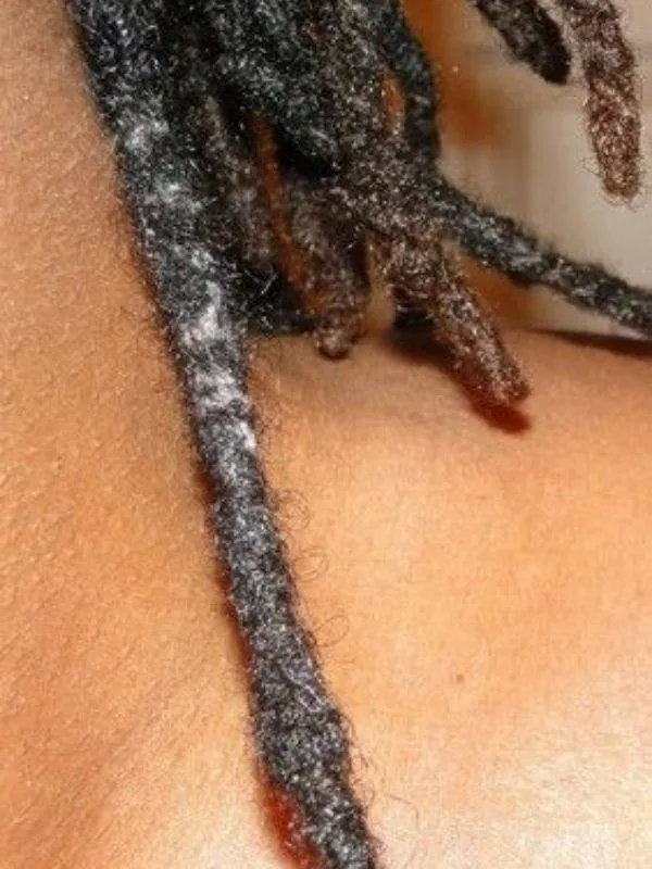 Locs