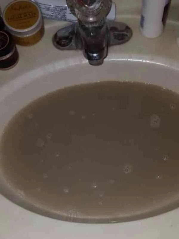 ACV-Rinse-Ratio-for-Sensitive-Scalp-Locs