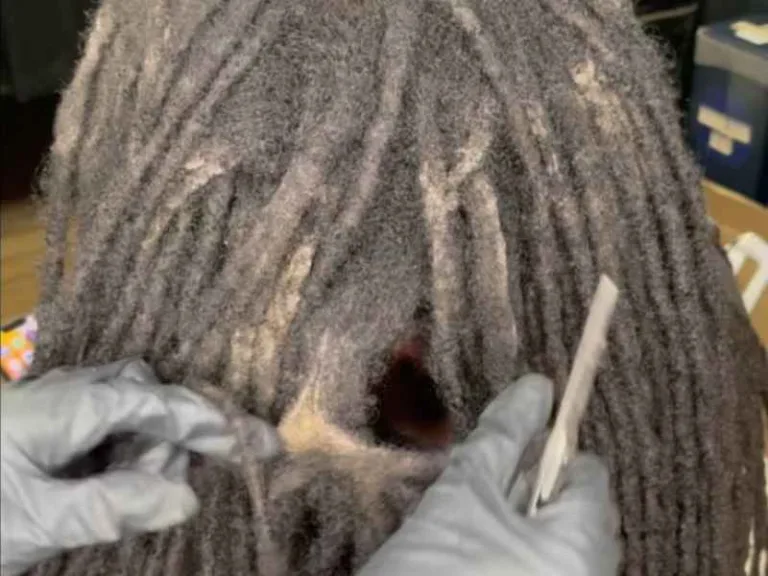 Lint